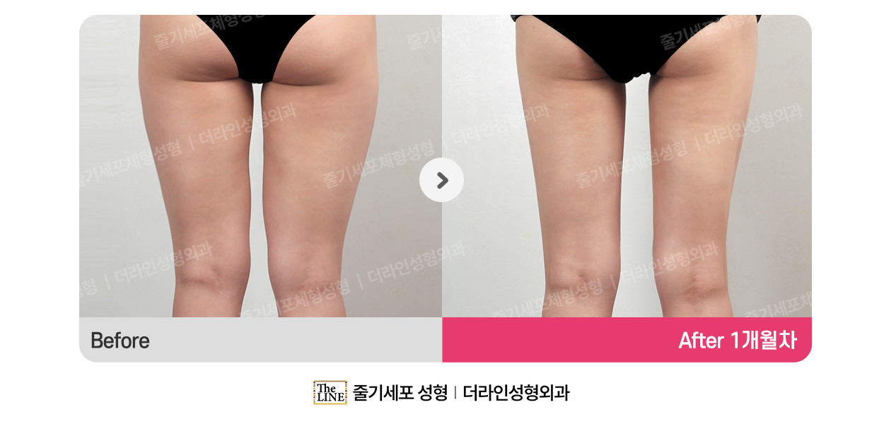 전사진