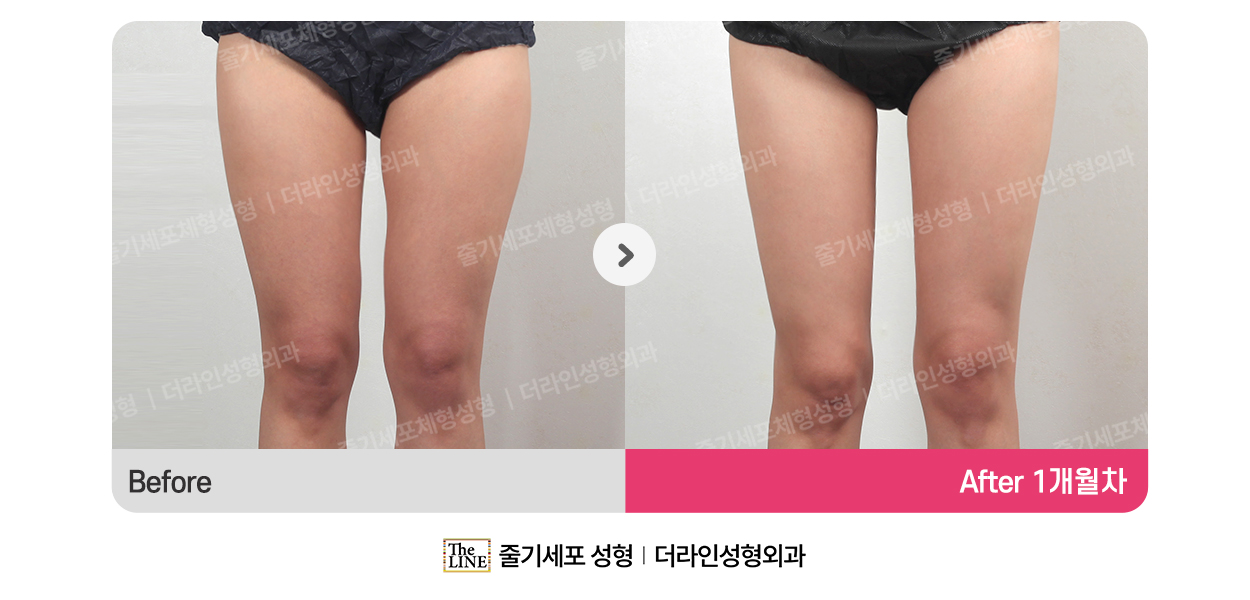전사진