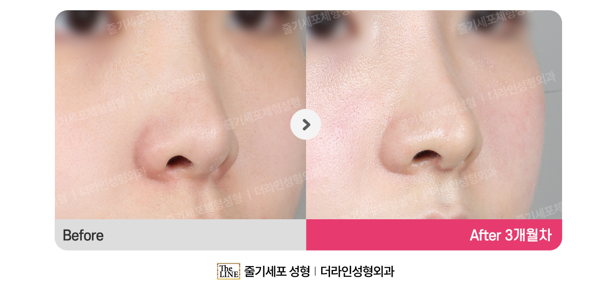 전사진