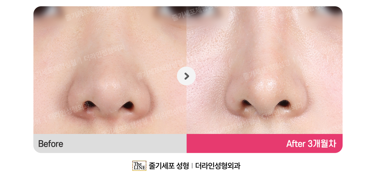 전사진