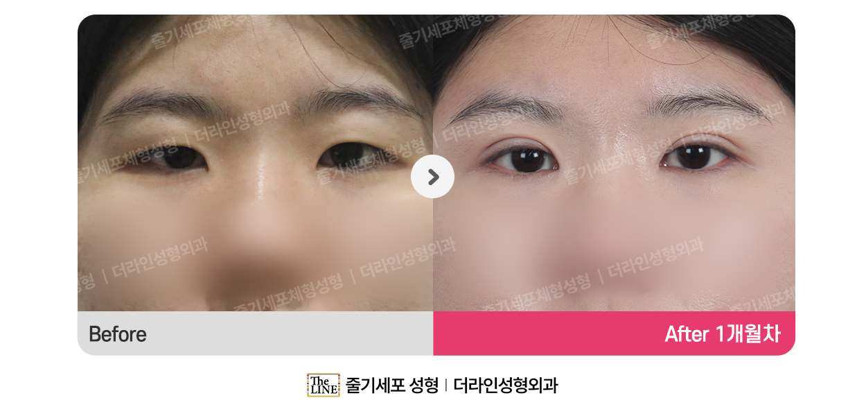 전사진