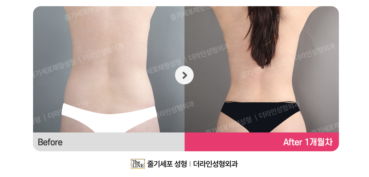 전사진