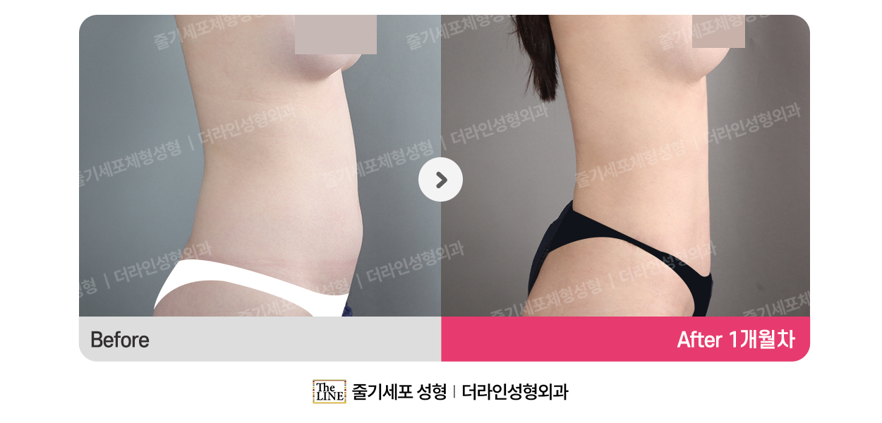 전사진