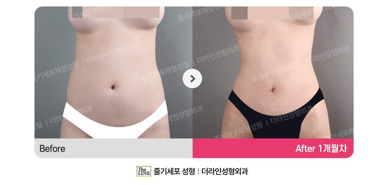 전사진