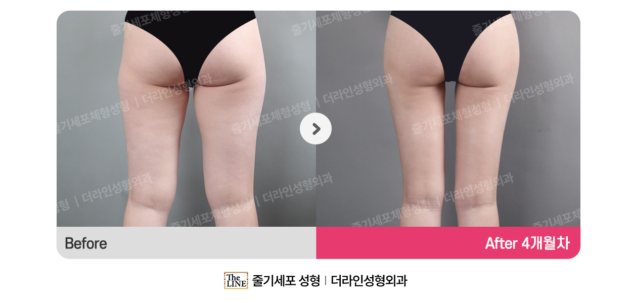 전사진