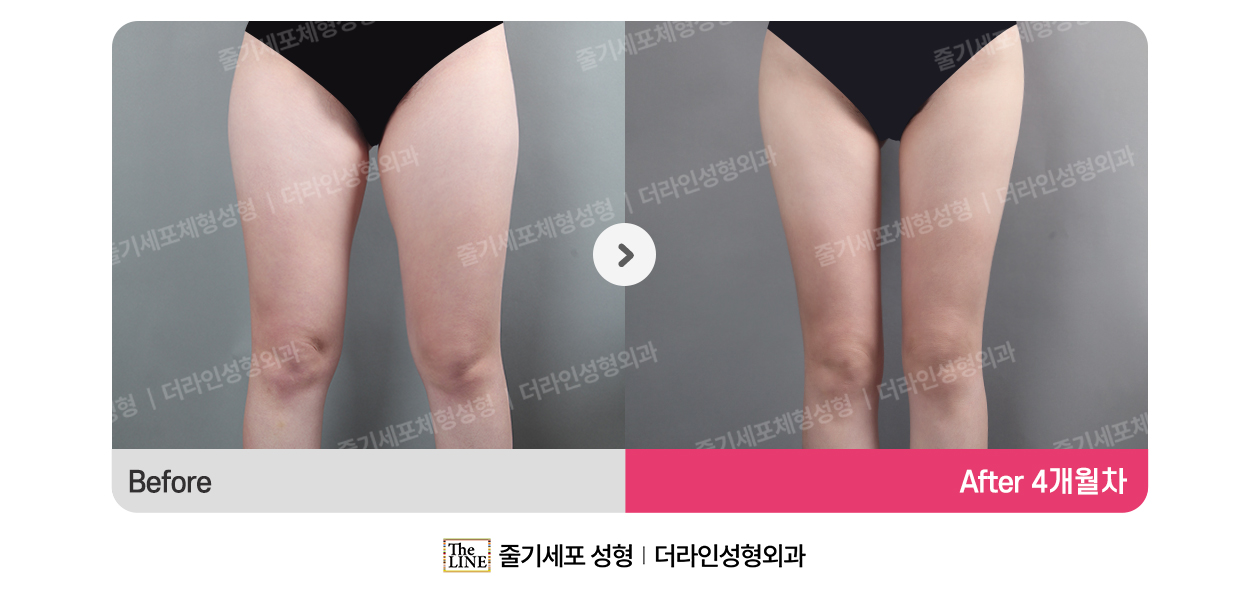 전사진