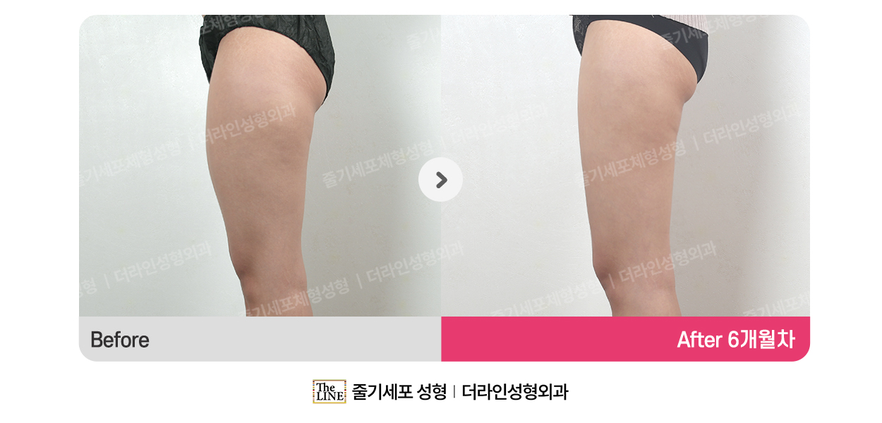 전사진
