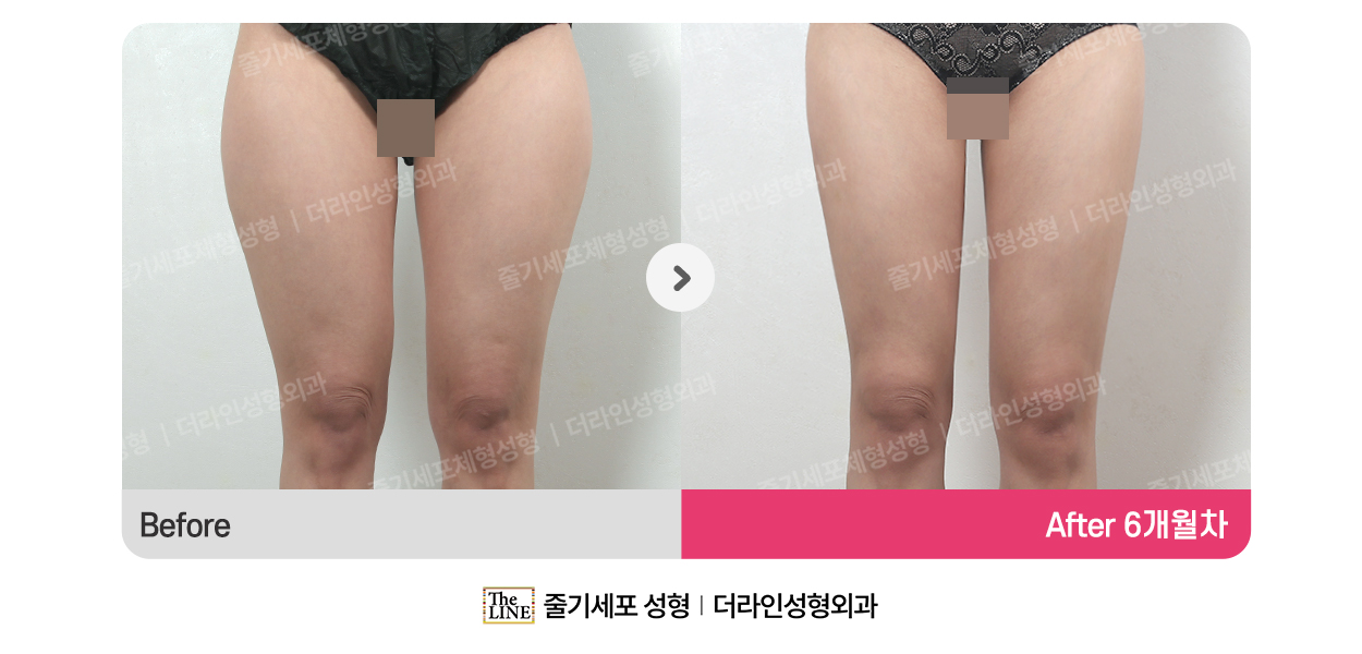 전사진