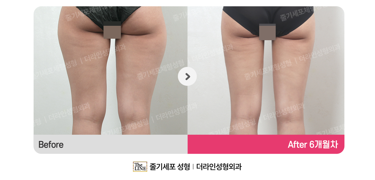 전사진