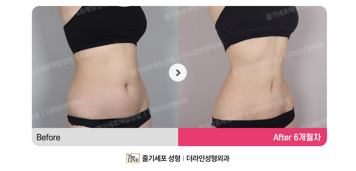 전사진
