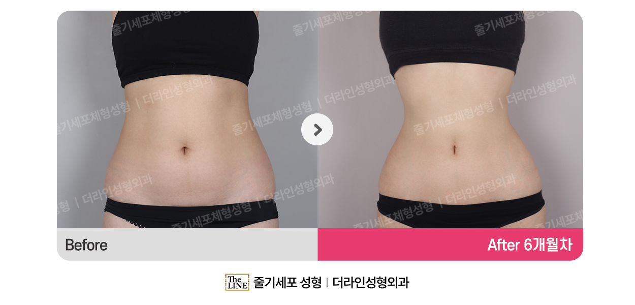 전사진