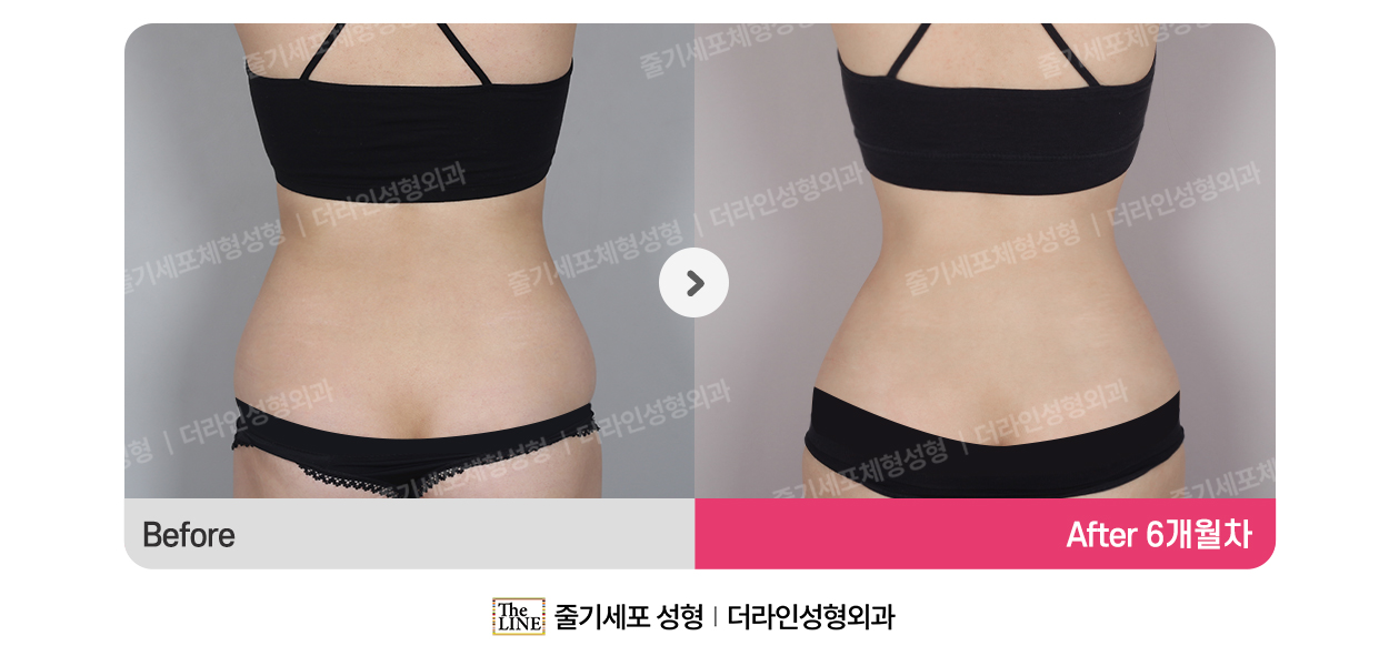 전사진