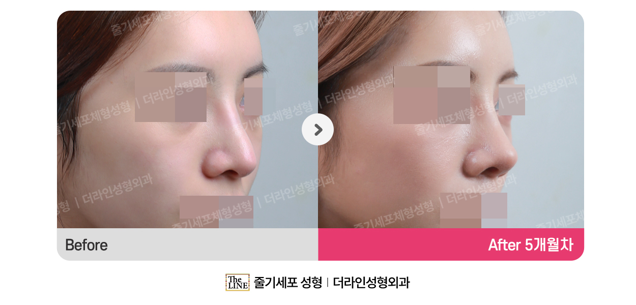전사진