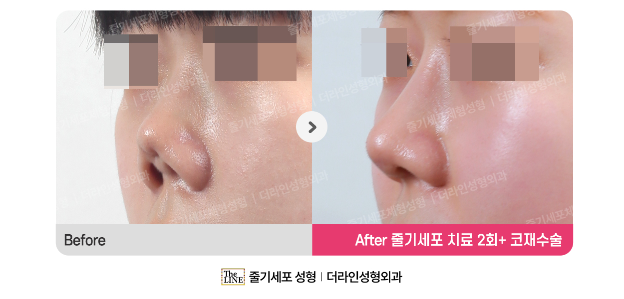 전사진