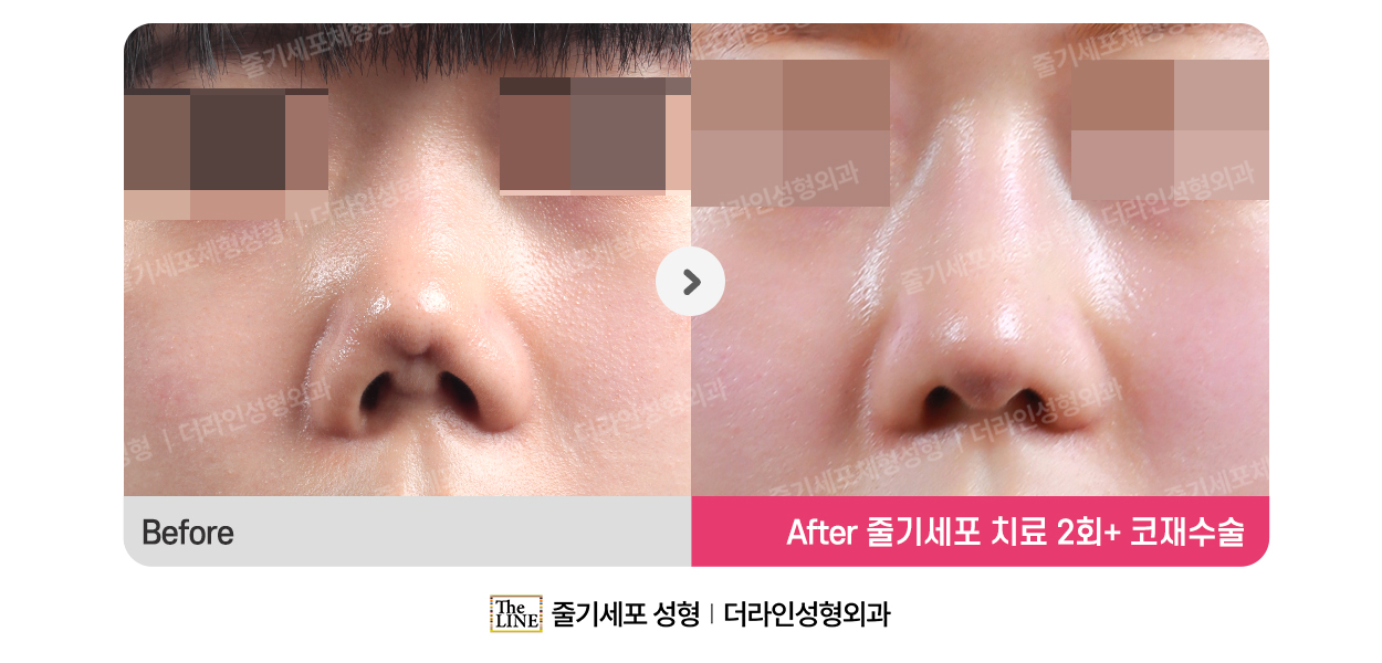 전사진
