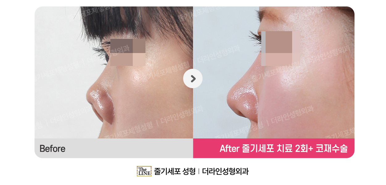 전사진