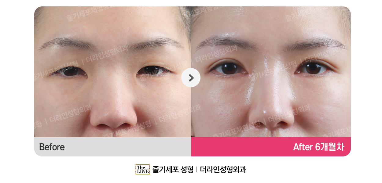 전사진