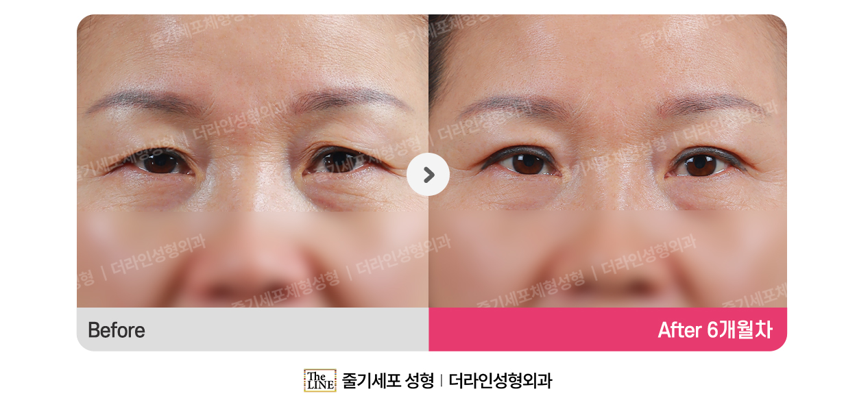 전사진