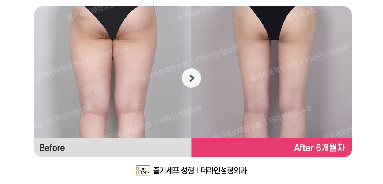 전사진