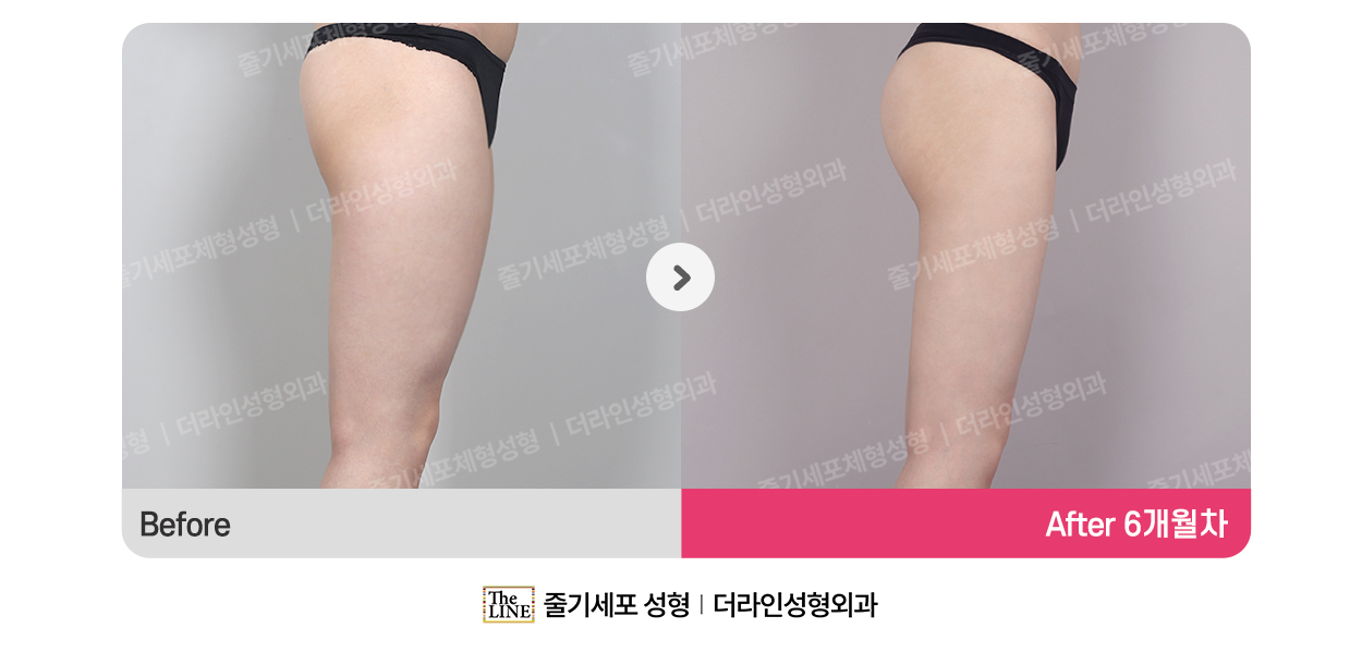 전사진
