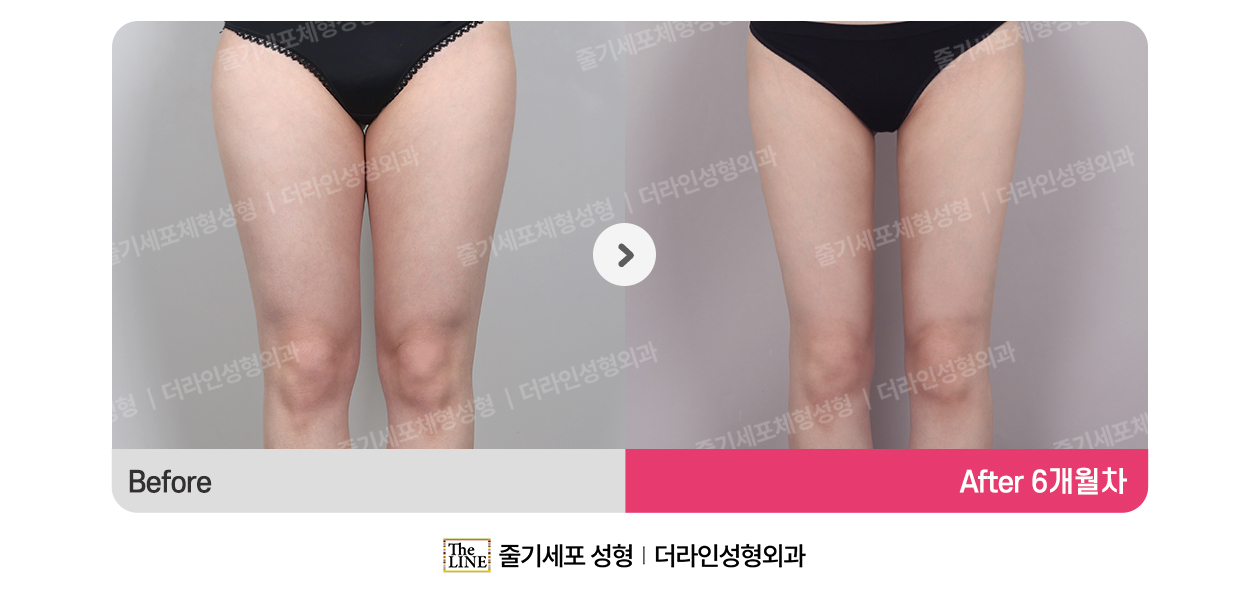 전사진