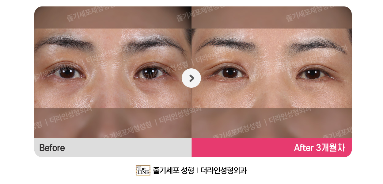 전사진