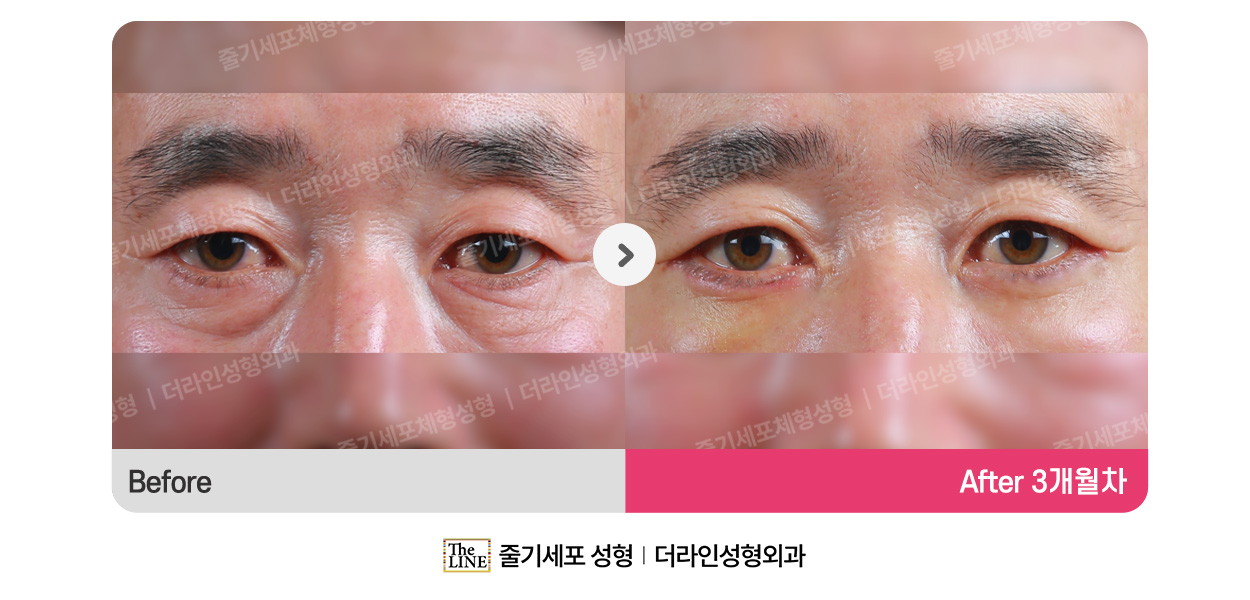 전사진