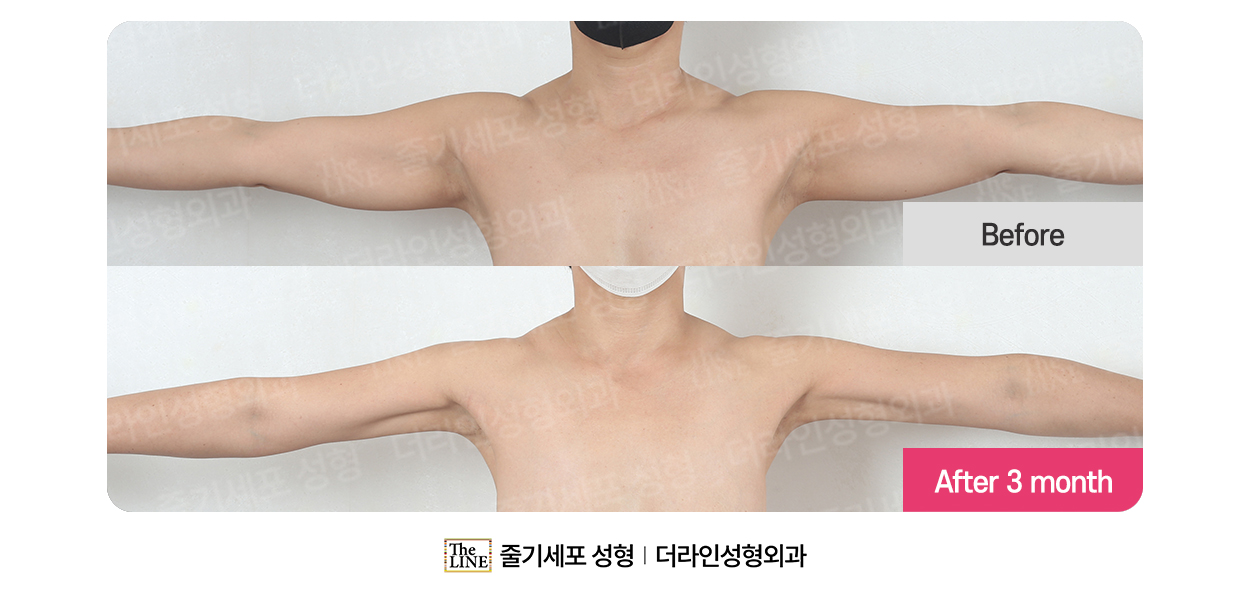 전사진