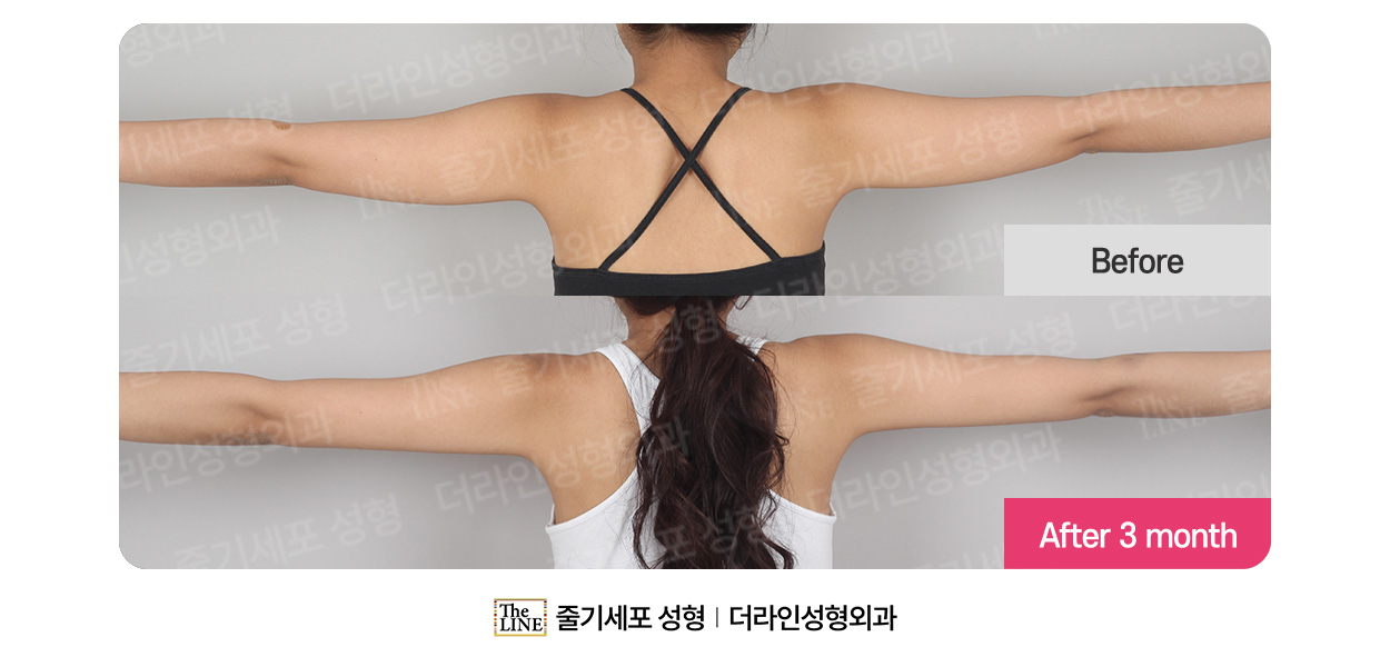 전사진