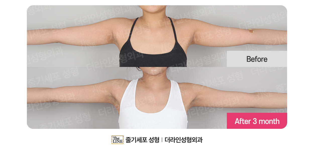 전사진