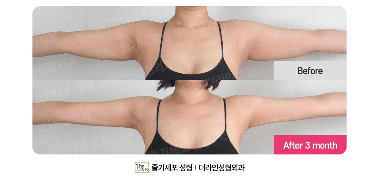 전사진