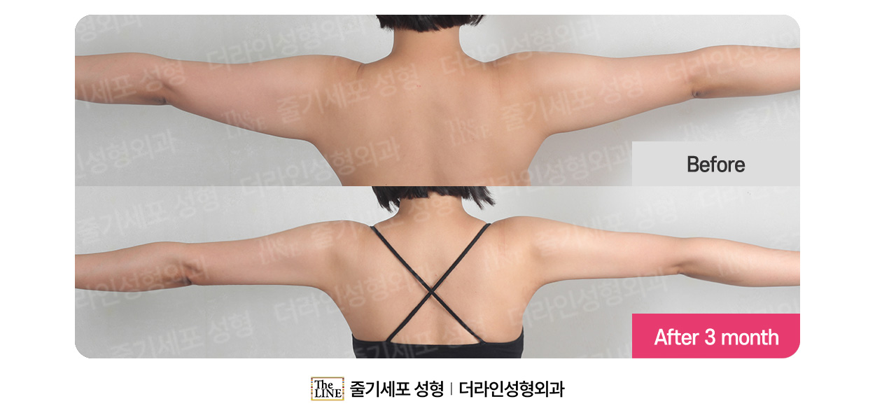 전사진
