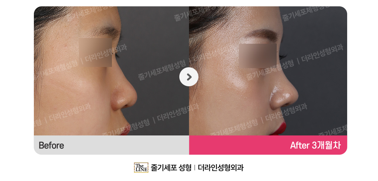 전사진