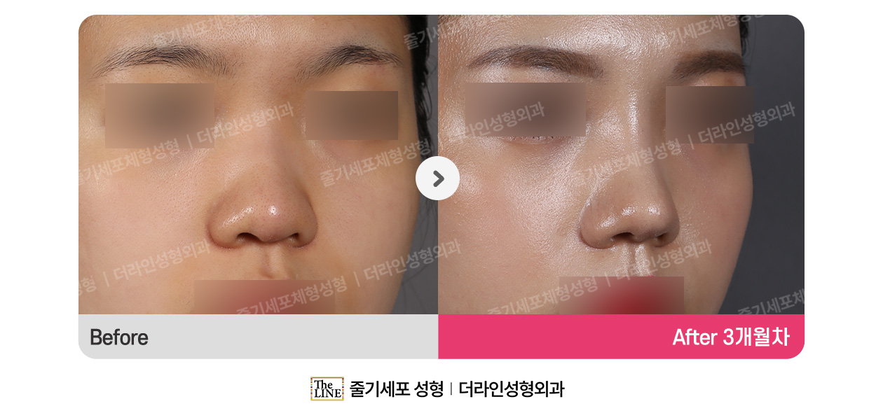 전사진