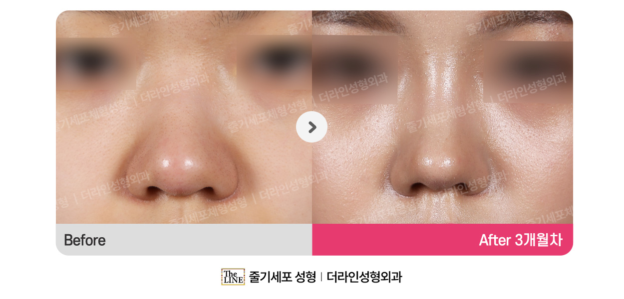 전사진