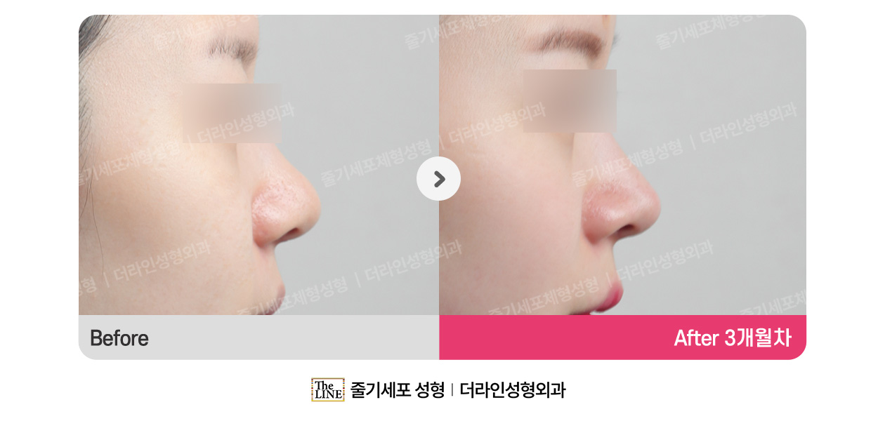 전사진