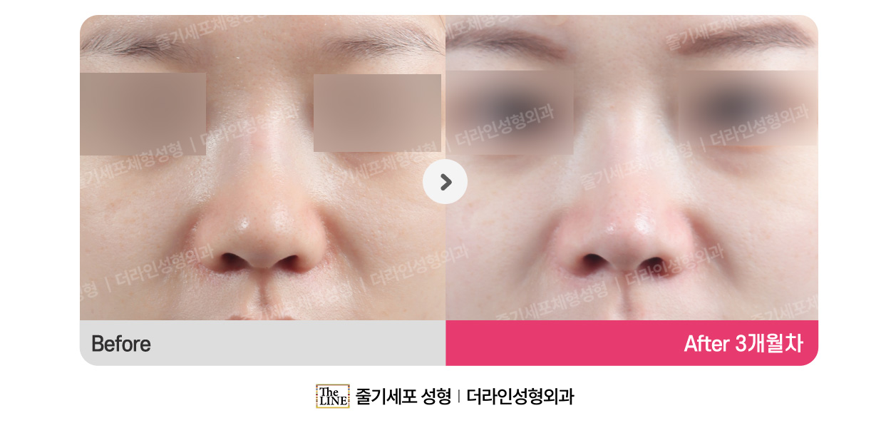 전사진