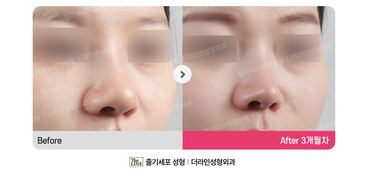 전사진