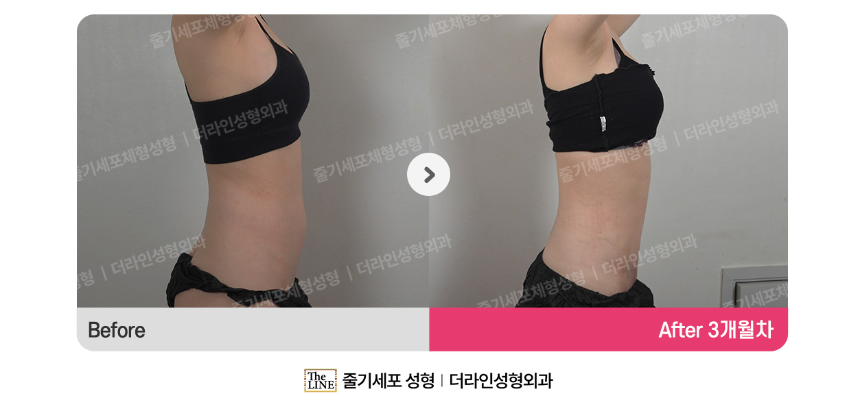 전사진