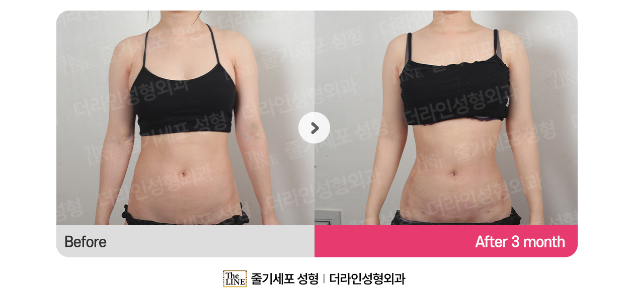 전사진