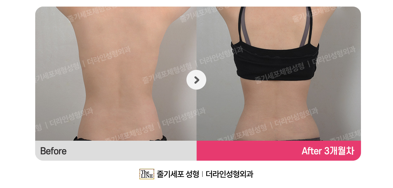 전사진