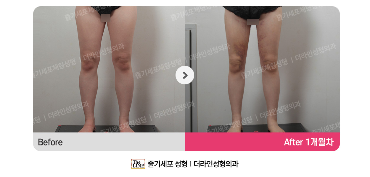 전사진