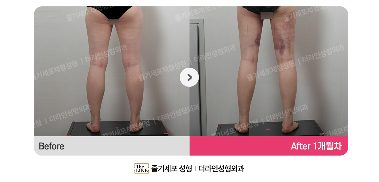 전사진