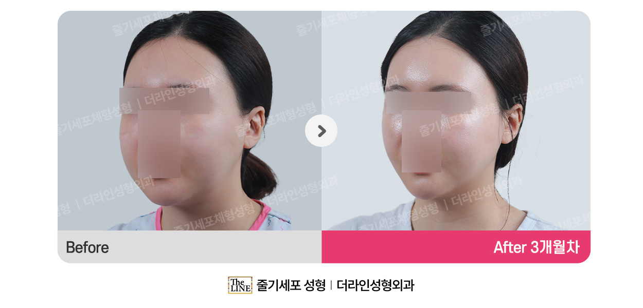 전사진