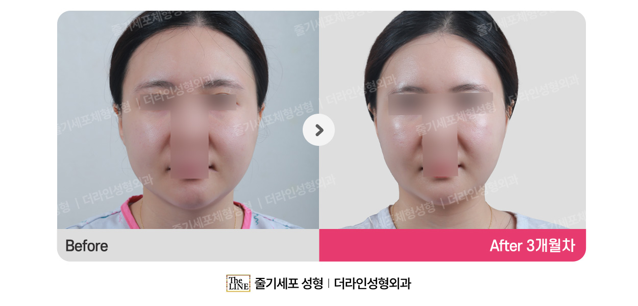 전사진