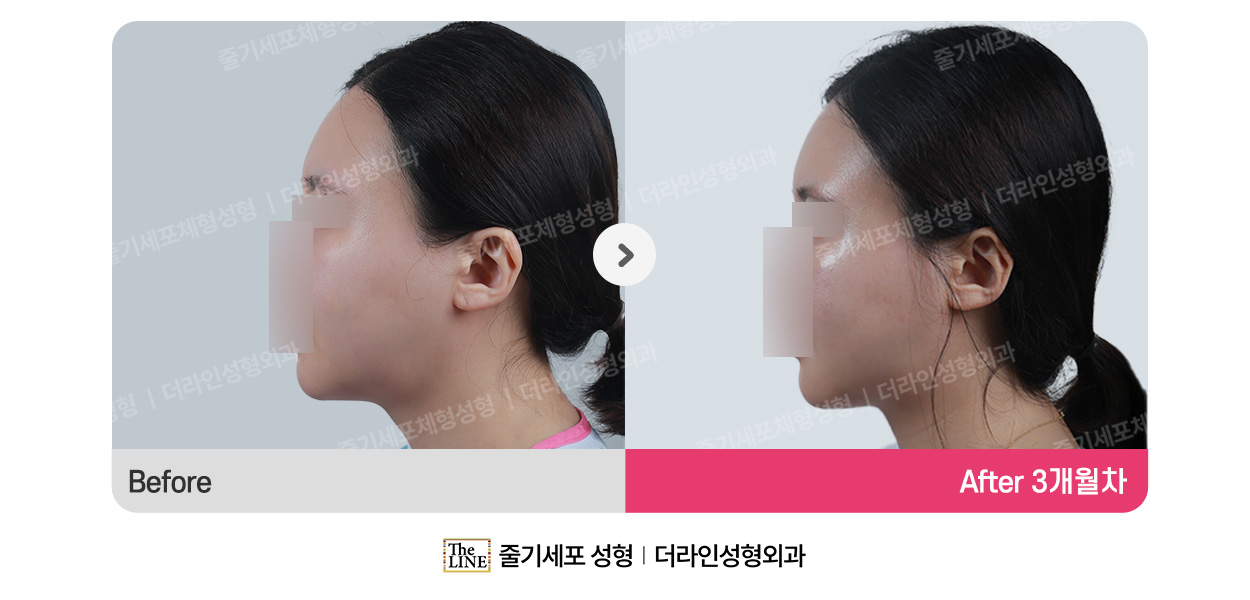 전사진