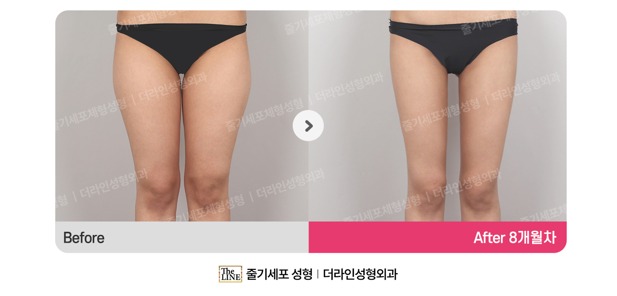 전사진