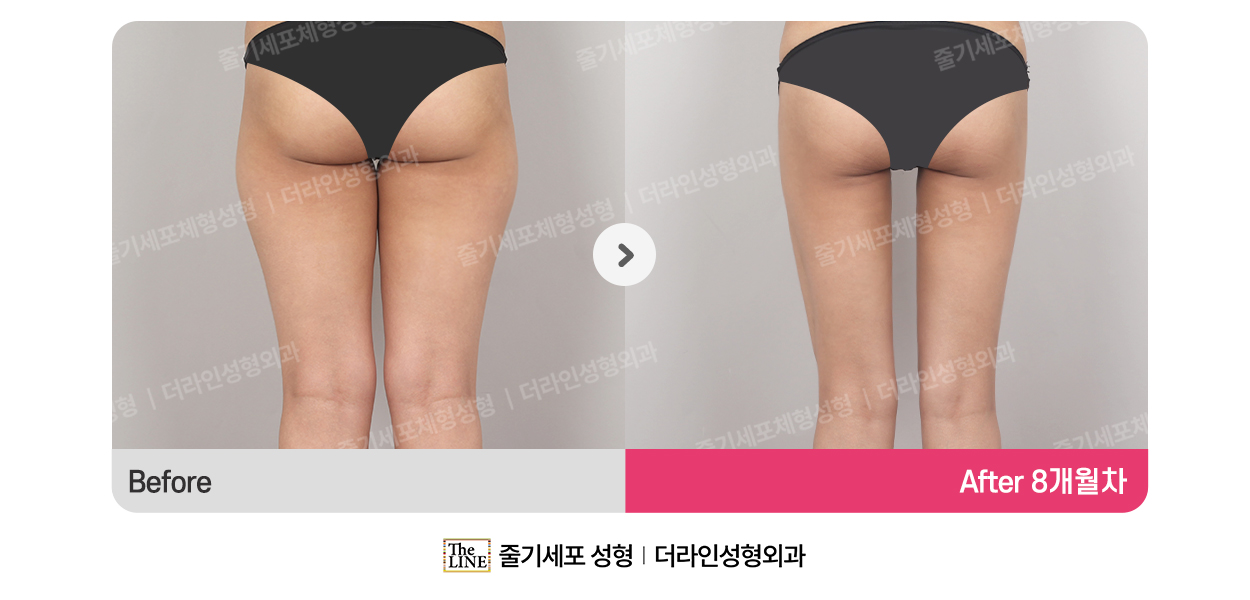 전사진