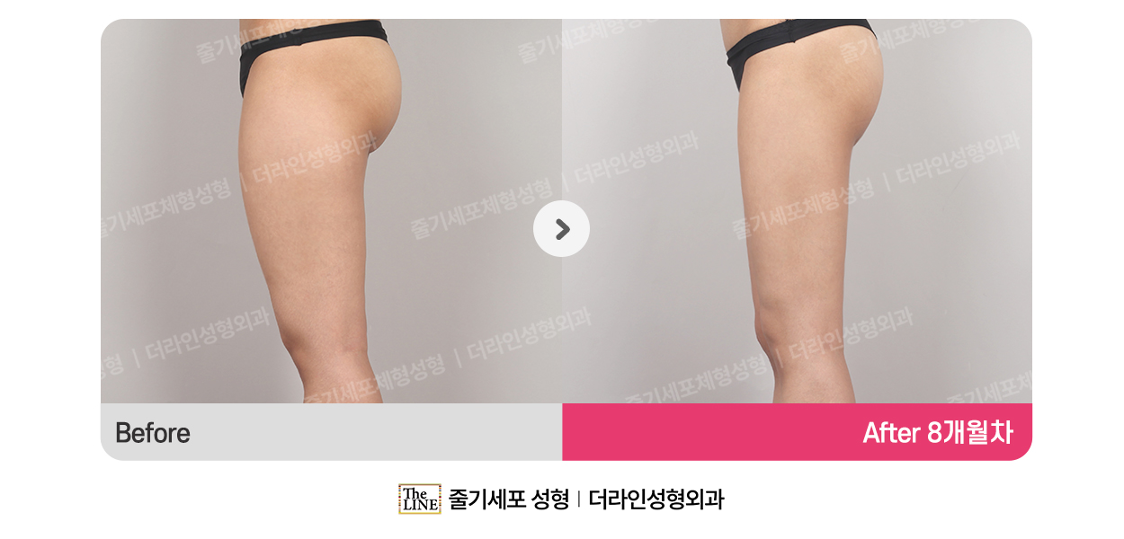 전사진