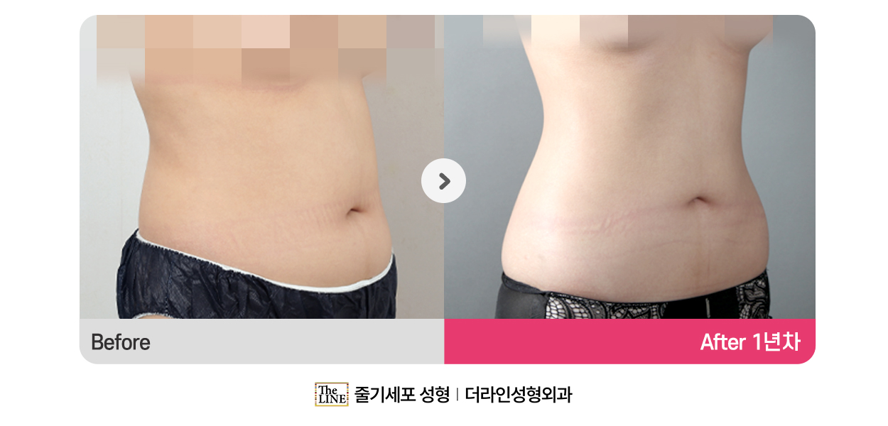 전사진